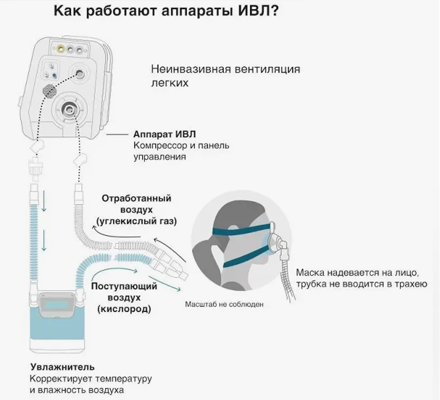 Принцип осуществления неинвазивной вентиляции легких