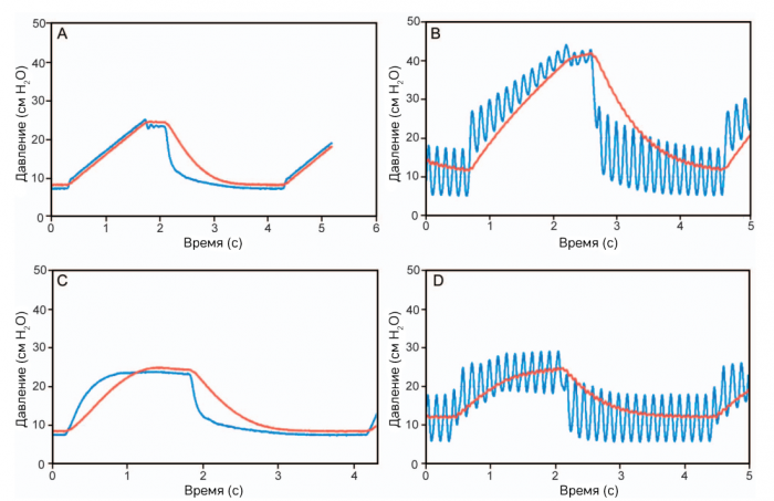 IPV + конвенциональная вентиляция: сравнение режимов с контролем по объему и давлению