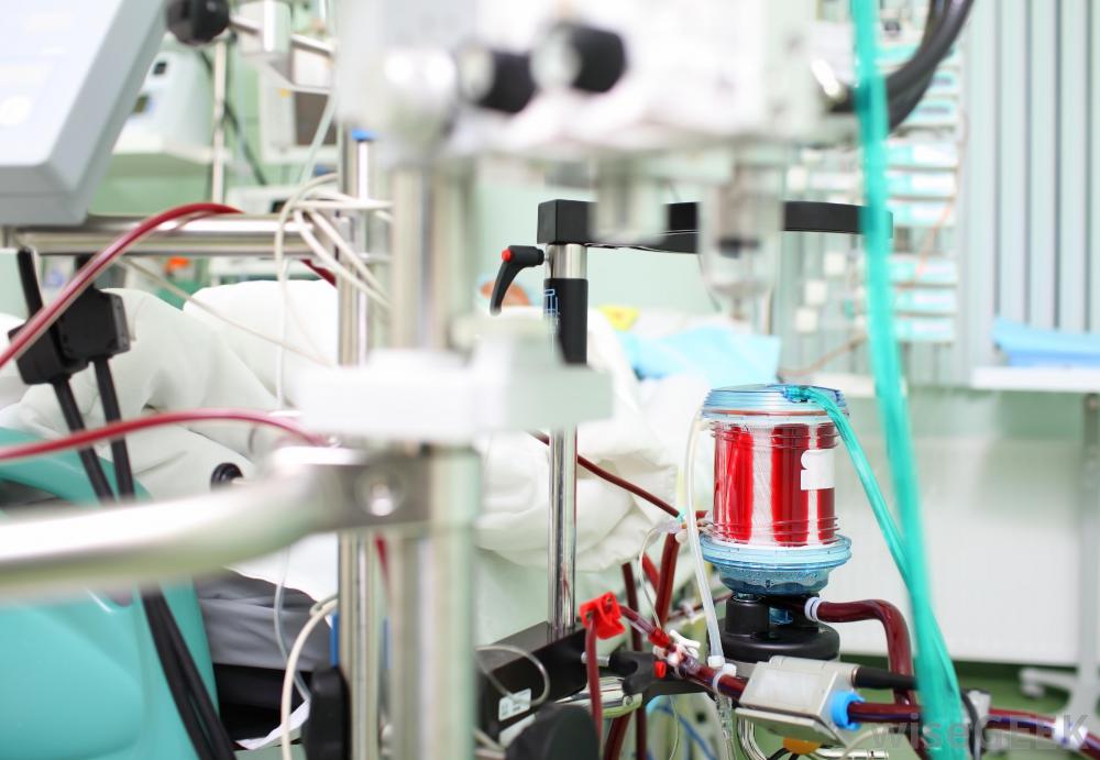 ecmo-machines.jpg