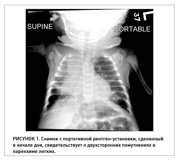 ИПВ коклюш 01.png